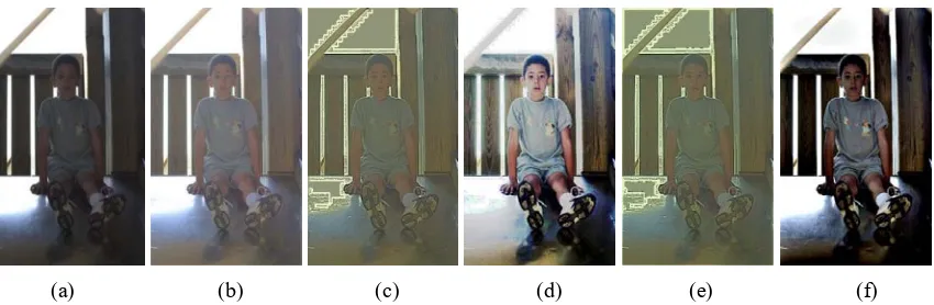 Figure 7: Results for image Baby girl standing.  (a) Original image, (b) Enhanced image of NFPF, (c) Enhanced image of NNAE, (d) Enhanced image of HE, (e) Enhanced image of PNAE, and (f) Enhanced image of MSRCR