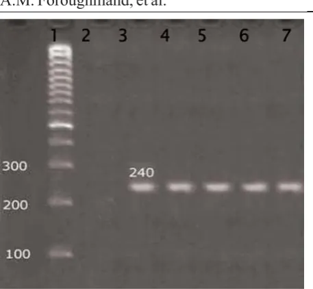 Fig. 2. Digested PCR products with the restriction en-zyme TspR1 yielded 4 bands in the case of AT allele (line