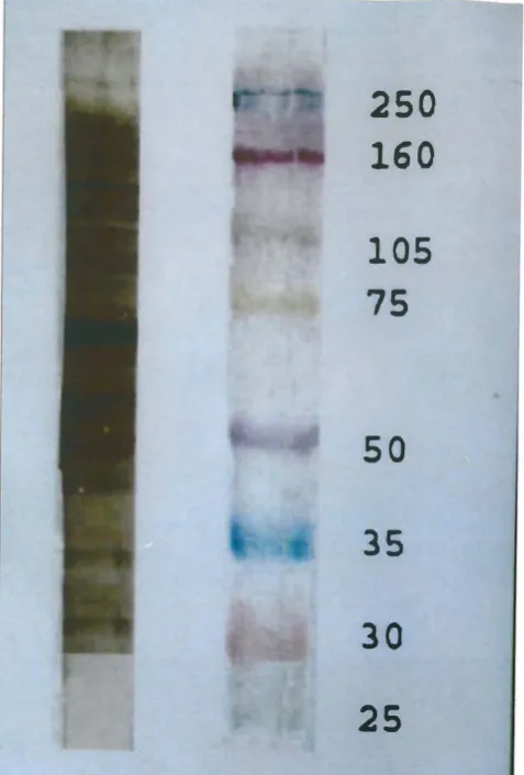 Fig. 1. SDS-PAGE (12% agar) analysis of whole cell wall extract of Candida albicans (20 bands are present)