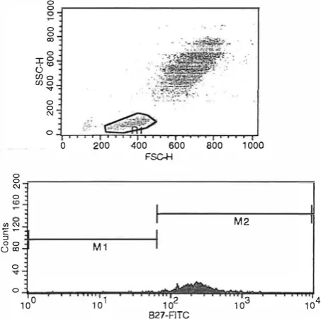 Fig, 3. An HLA-B27 positive case. 