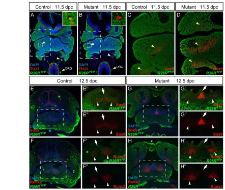Fig. 4. Foxd3 regulates timing of mesenchymal differentiation in cranial NC. (Images were captured at identical exposures for control and mutant sections and manipulated in a similar manner