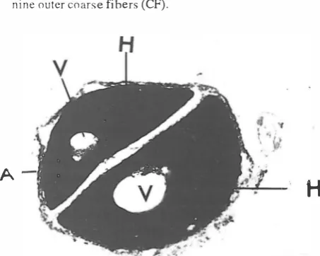 Fig. 2. Longitudinal section through head and neck region of sperm (x22,SOO). The plasma membrane (PM) surrounds the entire sperm cell