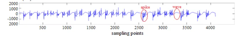 Figure 2: Sample of distribution of EEG amplitude from the data (a) Set A has normal distribution (bell shape) and center amplitude (b) Set B has normal distribution (bell shape) and center amplitude (c) Set C has normal distribution 