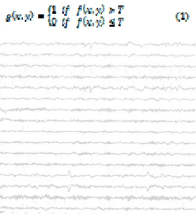 Figure 6: The extracted Signals  