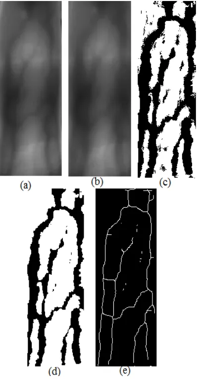 Figure 3: image pre-processing and finger vein pattern extraction. (a) Original IR image (b) Median filter (c) Image Binarization (d) After Dilation (e) After Thinning