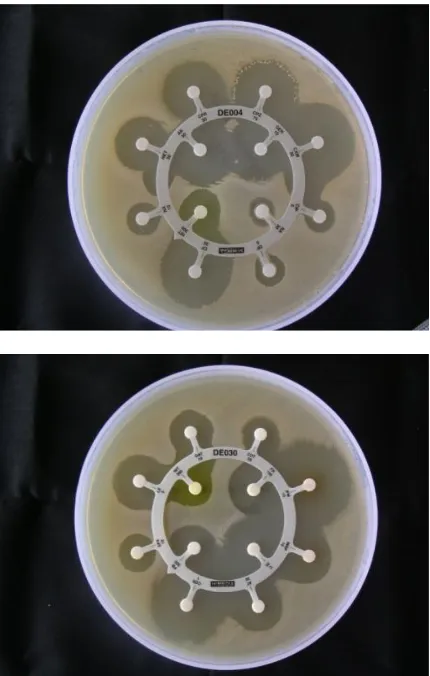 Fig. 4. Sensitivity test of Citrobacter sp. against antibiotics  