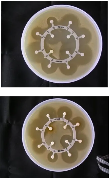 Fig. 10. Sensitivity test of Enterococcus feacalis against antibiotics  