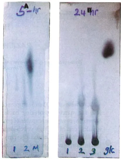 Fig. 2. Thin�layer chromatography of the products formed from starch solution in five hours (A) and twenty two hours (8)