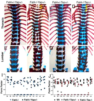 Fig. 5. Loss of Yap or Taz does not rescue the Fat4−/−vertebral defects. (A-H) Alcian Blue and Alizarin Redstaining of P0 thoracic (A-D) and lumbar (E-H) vertebrae ofmice of the indicated genotypes