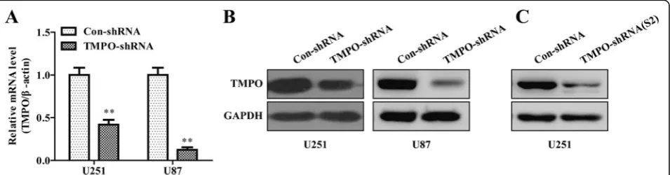 Fig. 2 Knockdown efficiency of TMPO by lentivirus infection in the GBM cells.TMPO-shRNA(S2) effectively decreased the protein expression of TMPO in U251 cells