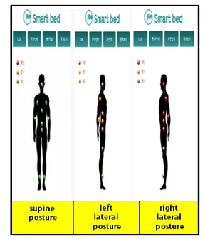 Figure 11: Visualization Of The Duration Time Of Pressure With Respect To Supine Position (left), Lateral 