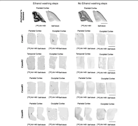 Fig. 2 Representative images of phosphor screen autoradiography experiments with and without ethanol washing steps