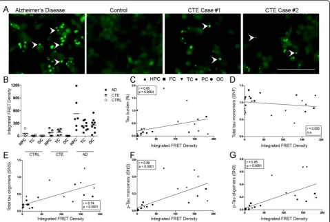 Fig. 4 Representative confocal microscopy images showing tau aggregates in cells exposed to AD and CTE temporal cortex brain lysates (whitearrow heads)