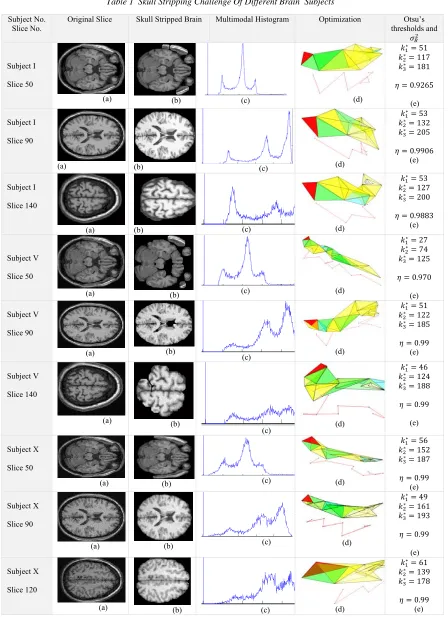 Table 1  Skull Stripping Challenge Of Different Brain  Subjects  