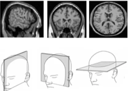 Figure 4 (a) Row1: sagittal slice, coronal slice, axial Slice Figure 4(b) Row2:  sagittal plane, coronal plane, 