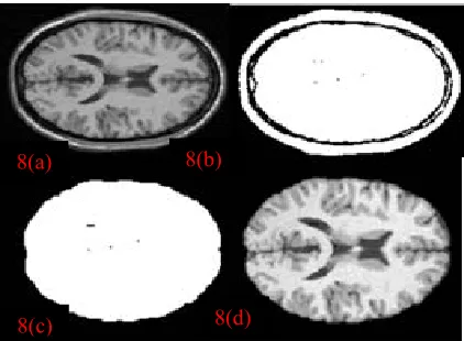Figure 9(b) is obtained by smoothing the brain slice 