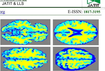 Figure 11 Binary Images Obtained By Otsu’sSegmentation 