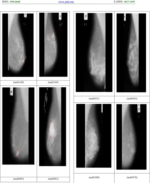 Figure 4: Benign mammogram images