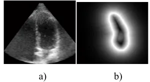 Figure 4: a) One slice of echocardiography volume, b) Corresponding distance map of extracted slice 