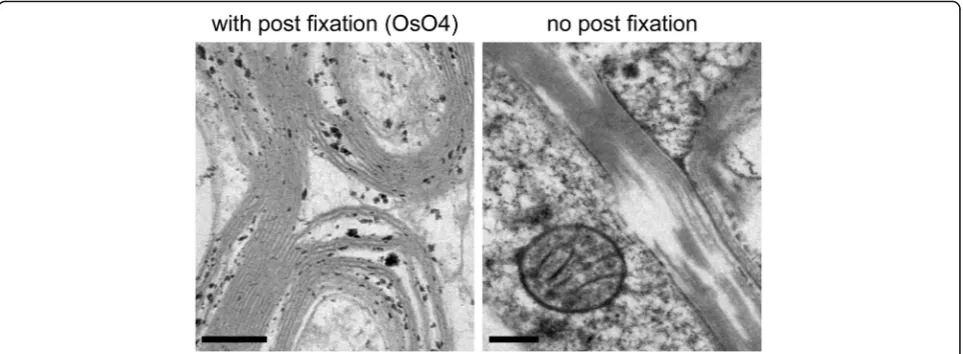 Fig. 1 Electron micrographs of human brain samples (case 5) with and without post fixation with osmium tetroxide before the HPF