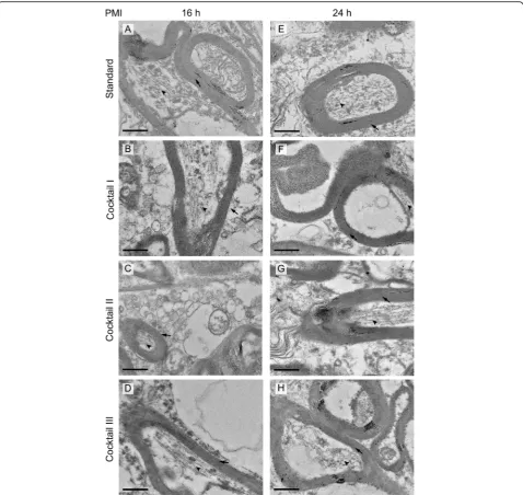 Fig. 2 Electron micrographs of human brain samples with different PMIs and cryo-substitution cocktails at X6500 magnification