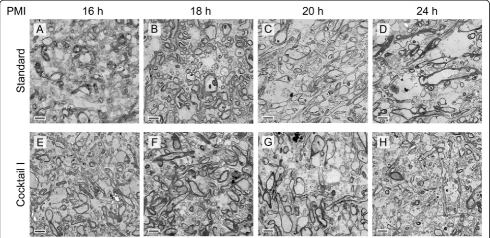 Fig. 5 Semi-thin sections of human brain samples. All samples were prepared with cryo-substitution cocktail I, and after cutting ultra-thin slices3, PMI 20 h, frontal white matter,500 nm thick semi-thin slices were dyed with toluidine blue