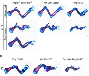 Fig. 2. Synergistic forelimb defects caused by Ring1Btrans RA. Pharmacological effects of all-trans RA on thecontrol (E17.5 are shown