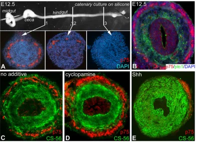 Fig. 10. Shh overexpression leads to aganglionosis and modifies CS-56 immunostaining in the mouse hindgut