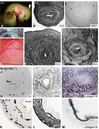 Fig. 7. Virus-mediated in ovo misexpression of Shhdisrupts ENS and ECM development. Injection ofRCAS-Shh into the chick E2 presumptive hindgutmesoderm leads to hindlimb polydactyly (A, digitsnumbered) and tailbud malformation by E5 (A, arrow)