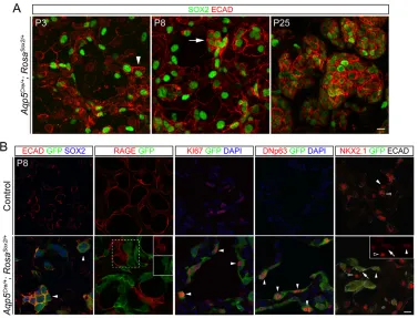 Fig. 5. Aqp5targeted withCre-driven ectopic SOX2expression reprograms flattened AT1cells