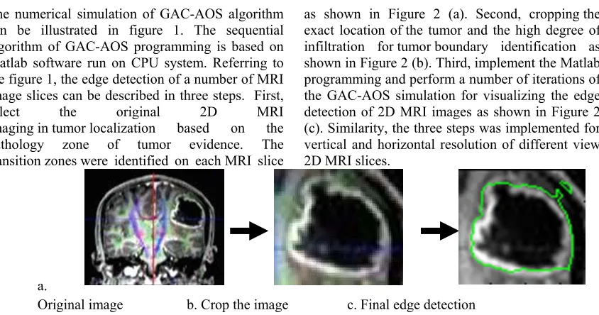 Figure 1: Flow chart of the GAC-AOS algorithm on 2D MRI images image   