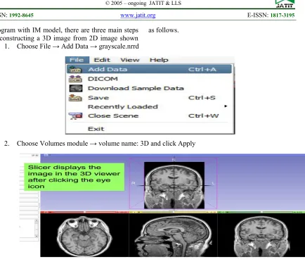 Figure Surface of 3D brain tumor visualization by using VE and IM