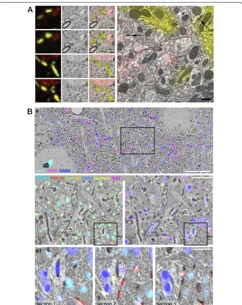Fig. 6. Fluorescence / Electron Array Tomography (FM/EM-AT) images representing the unique capacity of this modality to combine fluorescence andelectron imaging in volumetric register (part 1/2)