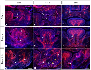 Fig. 1. Specific domains of ERKpathway activation in the craniofacialwhereas arrows indicate signals in theosteogenic progenitors