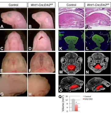 Fig. 2. Wnt1-Cre;Erk2severe craniofacial malformations.(A-D) Sagittal (A,B) and ventral (C,D)views of newborn control andin Q