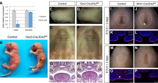Fig. 4. Cleft palate is a consequence of tongue and mandible malformations in Wnt1-Cre;Erk2indicates milk in the stomach of the(red) of coronal sections of E13.5 cultured explants