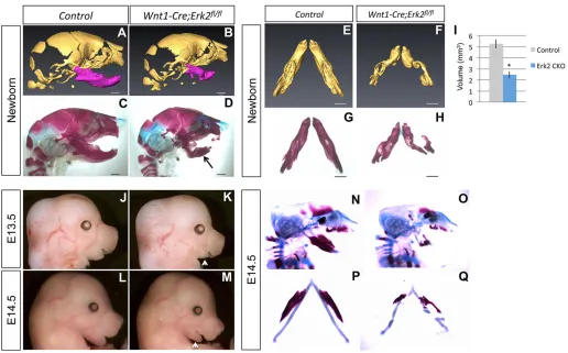 Fig. 8. The onset of mandibular defects precedes palatal shelf elevation. (A-D) Sagittal views of 3D reconstructions from microCT scans (A,B) and Alizarincontrol andRed/Alcian Blue staining (C,D) of newborn control and Wnt1-Cre;Erk2fl/fl skulls