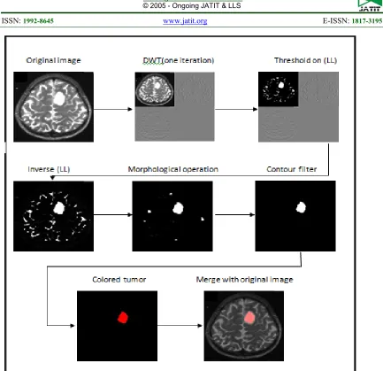 Figure 11: Tumor Detection With Contour In Frequency Domain 