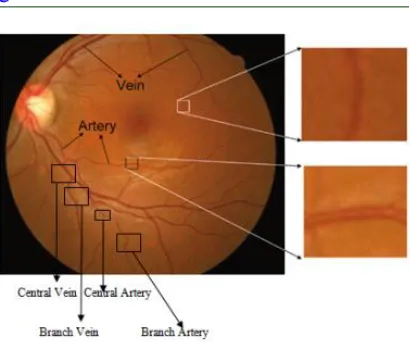 Figure 1: Artery and vein in fundus image  