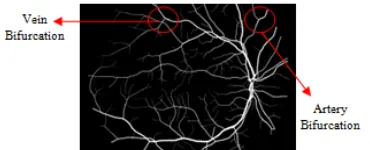 Figure 4 : The Extracted Blood Vessel Image 