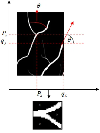 Figure 8 : Bifurcation Of Blood Vessel Pixel  