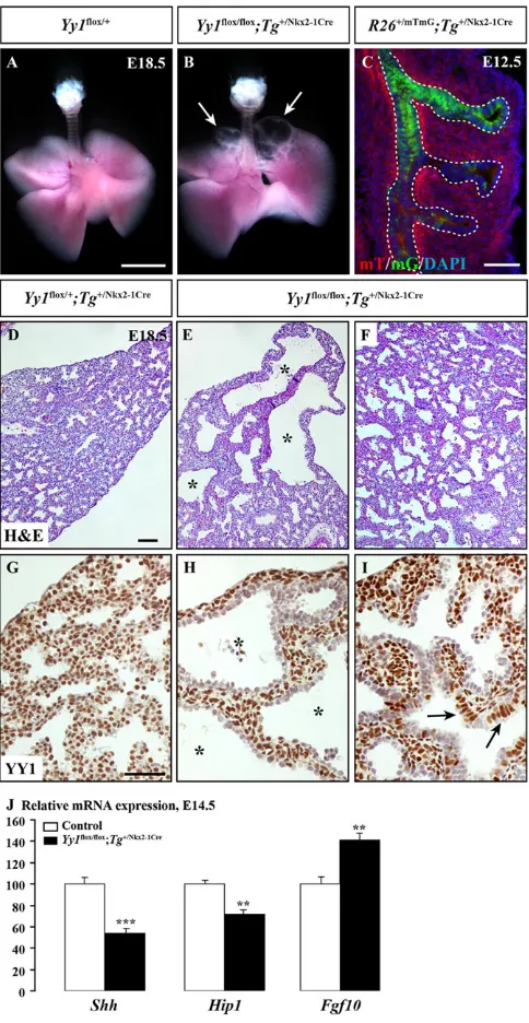 Fig. 5. Yy1of the lobes (arrows). (C) A robust Cre activity was detected in the proximalrespiratory epithelium from E12.5 inactivation in the developing lung endoderm with the Nkx2-1Cre transgenic mouse line causes cyst formation