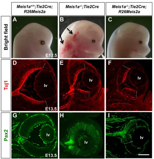 Fig. 4. Microphthalmia is not linked to Meis1 function in thehematopoietic/vascular system