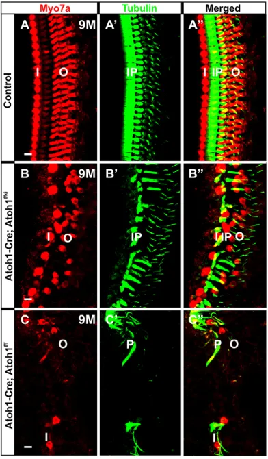 Fig. 4. Neurog1I, IHC; O, OHC; P, pillar cell (inner/outer). Scale bars: 10Immunohistochemistry of Myo7a and tubulin shows that, compared with thecontrol (A-A misexpression improves longevity of IHCs.″), both IHCs and OHCs and many SCs survive until 9 mont
