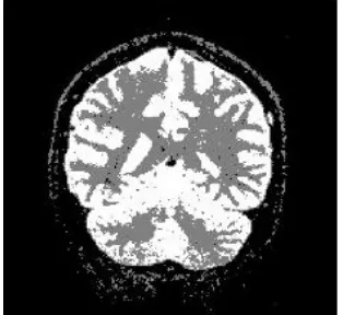 Figure 6: Proposed AWCKFCM 