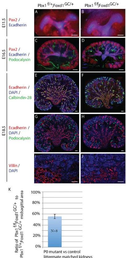 Fig. 3. VMC lineage-specific inactivation of Pbx1 does not affectnephrogenesis. (A-J) Control Pbx1f/+;Foxd1GC/+ and mutant Pbx1f/f;Foxd1GC/+kidneys at E11.5 (A,B), E16.5 (C,D) and E18.5 (E-J) assayed by IF for thedetection of Pax2+ renal epithelial progeni