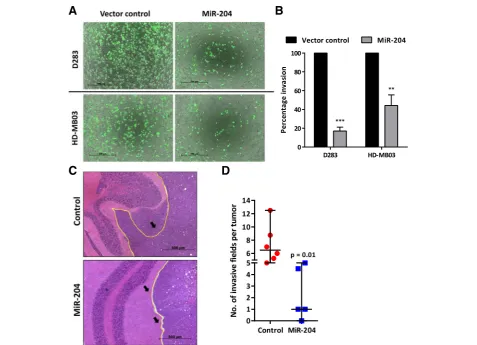 Fig. 5 Effect of miR-204 expression on in vitro and in vivo invasion potential of medulloblastoma cells