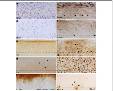 Fig. 7 Layer 1 in the LPFC and ACC of the adult human. All images in this figure were acquired from neurotypical adult cases (HCD, HCF,(labeled with black arrows), while CR (labeled with excitatory amino acid transporter (EAAT2) were not present in layer 1