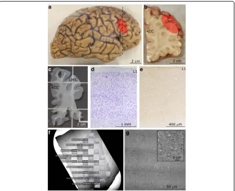 Fig. 1 Experimental design.Representative image of a 50 nm-thick section from LPFC gray matter on a pioloform-coated slot grid to show the unbiased systematic samplingscheme used to analyze axons at the EM level