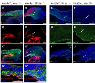 Fig. 6. Defective EMT in Wnt5aof E-cadherin (red) in T (green) in(E,F) Reduced expression of vimentin inexpression is extended ventrally and posteriorly.T expression in the ectopic cell accumulation inImmunofluorescent staining of sagittal sections ofposte